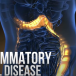 Inflammatory Bowel Disease | Dr Simon Ghaly